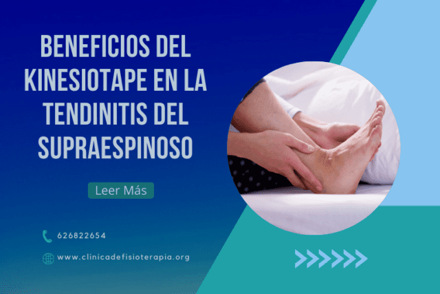 Beneficios del Kinesiotape en la Tendinitis del Supraespinoso