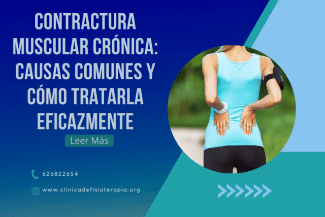 Contractura Muscular Crónica Causas Comunes y Cómo Tratarla Eficazmente