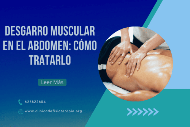 Desgarro Muscular en el Abdomen: Cómo Tratarlo